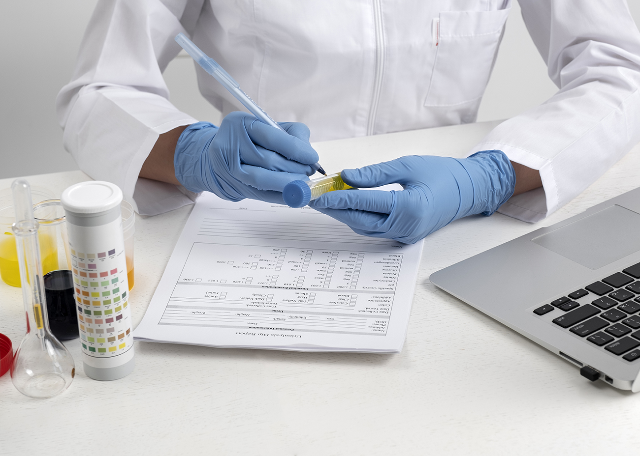 Laborantin oder Laborant mit blauen Handschuhen beschriftet ein Reagenzglas mit gelber Flüssigkeit, während ein Laborbericht ausgefüllt wird; daneben stehen Proben, Teststreifen und ein Laptop auf dem Tisch.